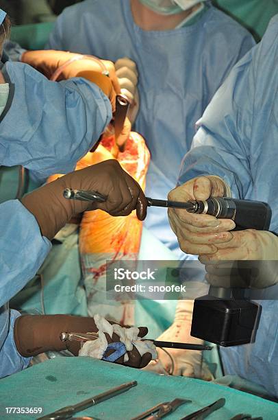 Protezy Stawu Kolanowego - zdjęcia stockowe i więcej obrazów Anatomia człowieka - Anatomia człowieka, Artretyzm, Badanie lekarskie
