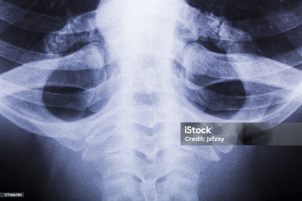 x-ray of Brust - Lizenzfrei Brustkorb - Tierkörper Stock-Foto