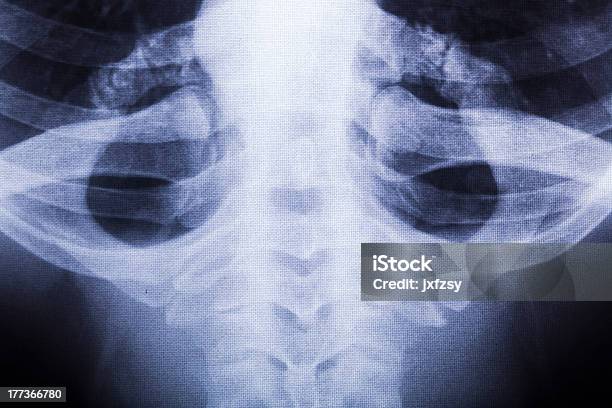 Xray Of Brust Stockfoto und mehr Bilder von Brustkorb - Tierkörper - Brustkorb - Tierkörper, Menschen, Anatomie