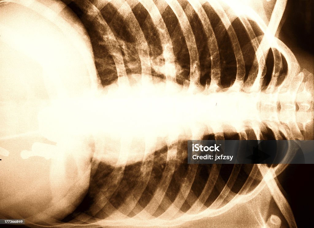 x-ray do peito - Foto de stock de Pessoas royalty-free