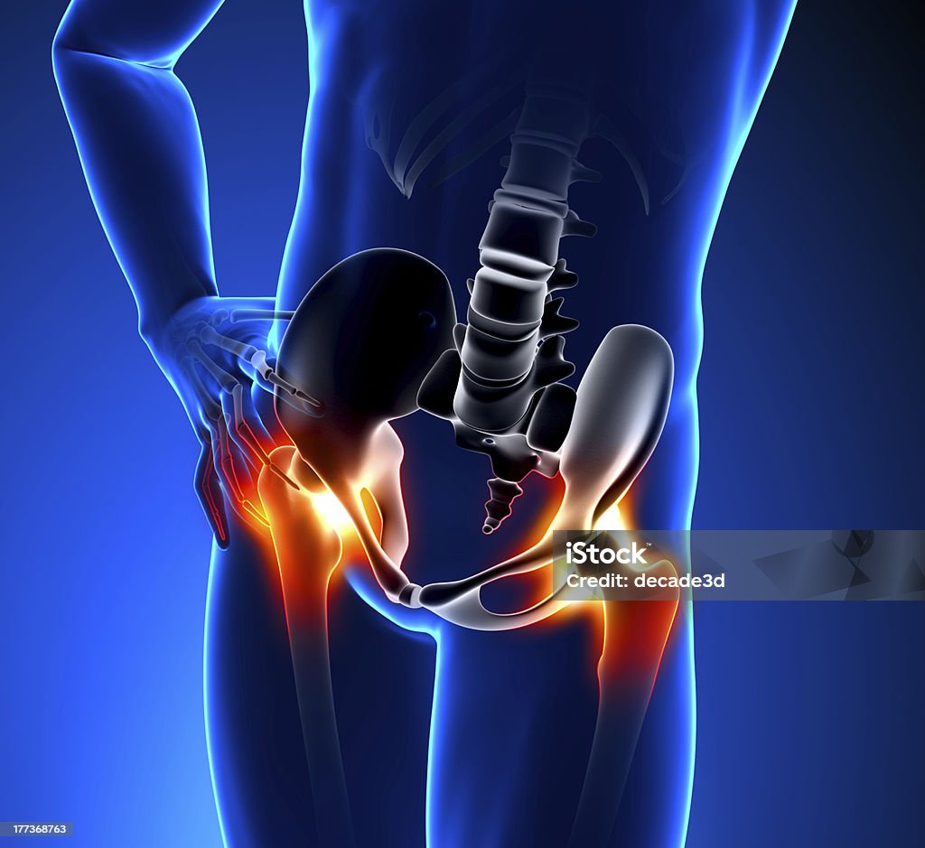 Koncepcja-ból kości biodrowej - Zbiór zdjęć royalty-free (Anatomia człowieka)