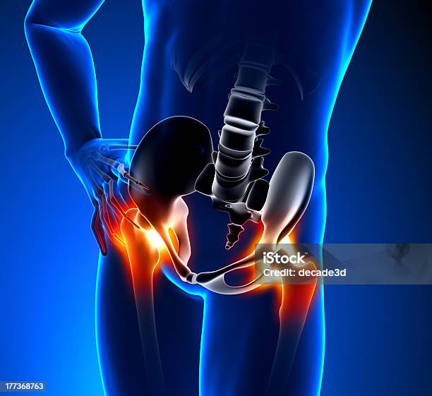 Koncepcjaból Kości Biodrowej - zdjęcia stockowe i więcej obrazów Anatomia człowieka - Anatomia człowieka, Artretyzm, Badanie lekarskie