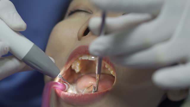 Close Up Of Woman Making Dental Scaling Treatment