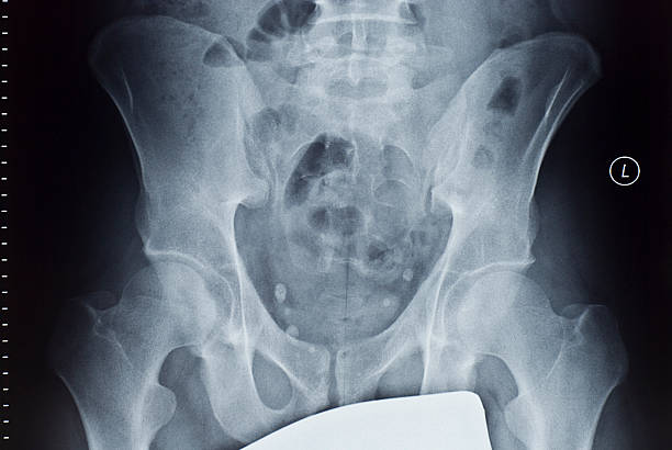 x 線 - cat scan pelvis hip human spine ストックフォトと画像