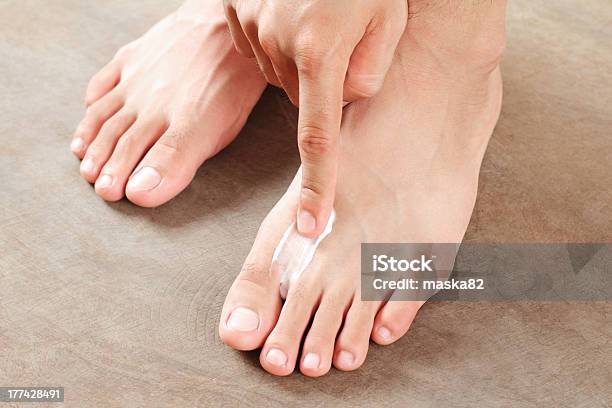 Athletes Foot Treatment Stock Photo - Download Image Now - Ointment, Athlete's Foot, Men