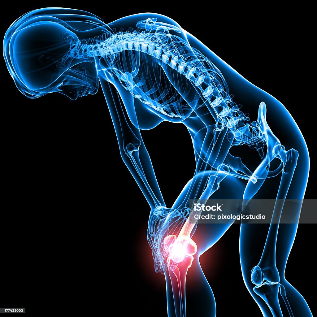 Ból kolana kobiety - Zbiór zdjęć royalty-free (Anatomia człowieka)