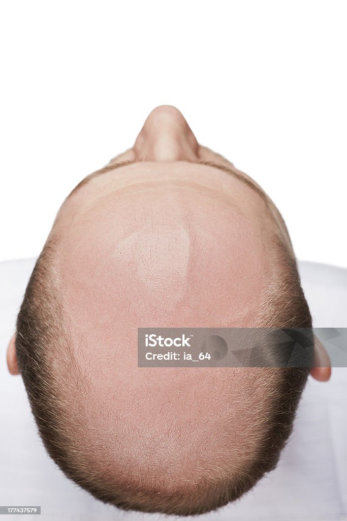 Bald homem cabeça - Foto de stock de Vista de Cima royalty-free