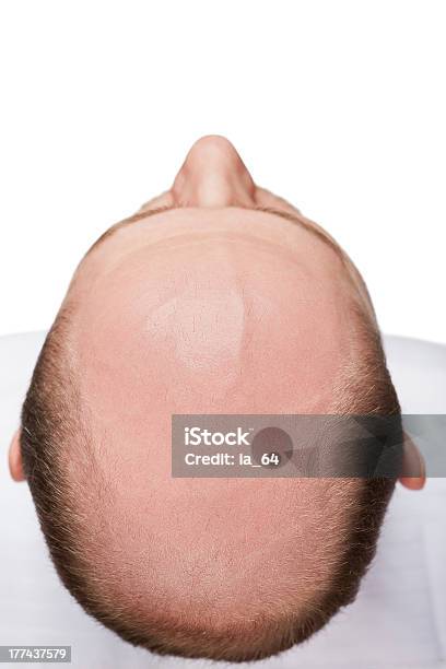 Foto de Bald Homem Cabeça e mais fotos de stock de Vista de Cima - Vista de Cima, Homens, Alopecia