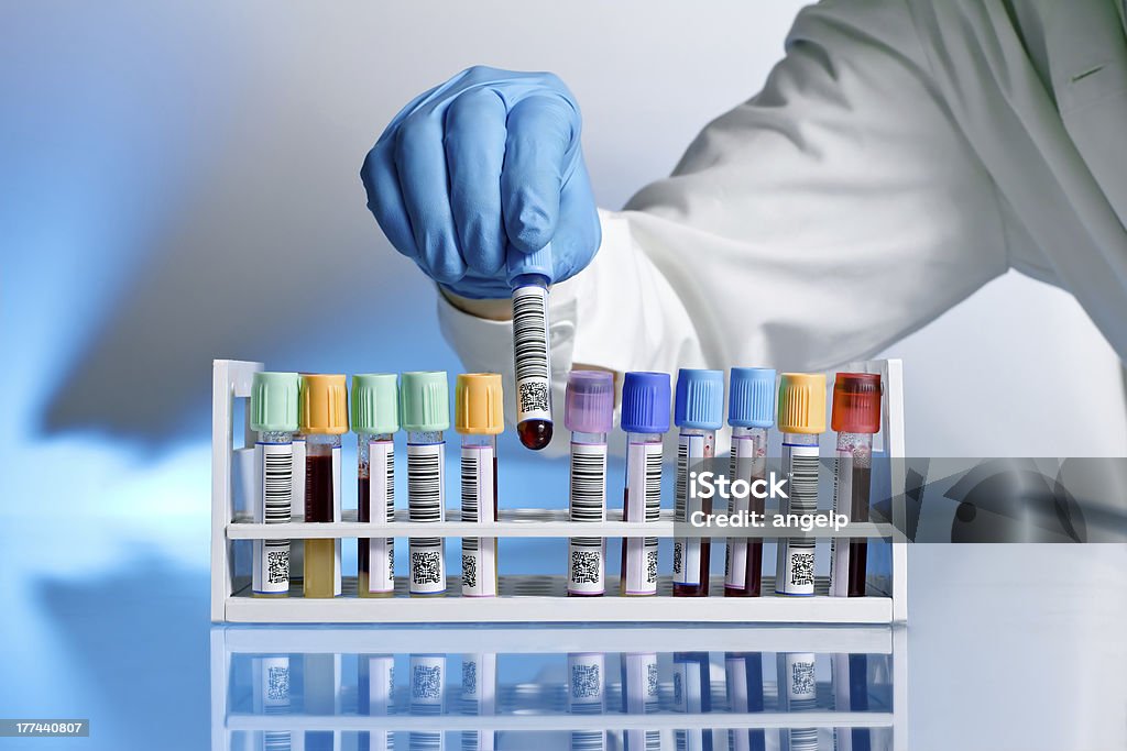 Doctor with test tube hand of a doctor taking a blood sample tube Laboratory Stock Photo