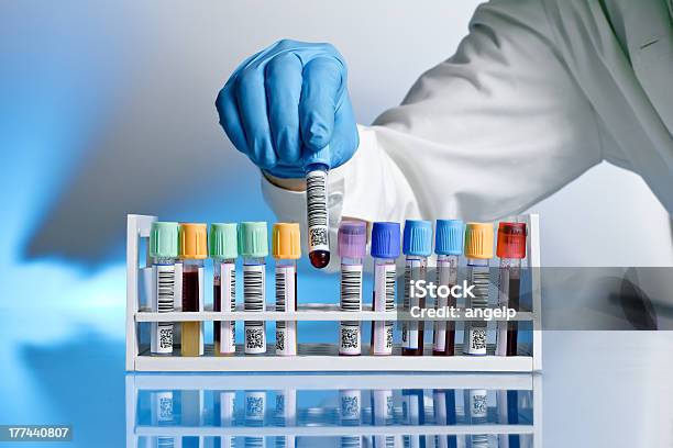 Doctor With Test Tube Stock Photo - Download Image Now - Laboratory, Blood, Scientific Experiment