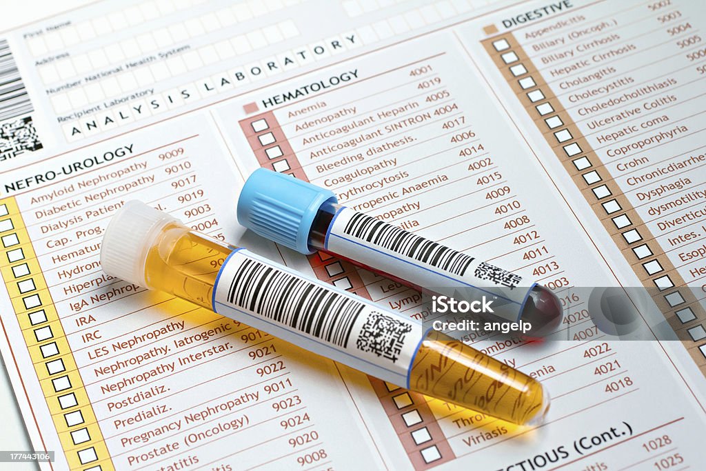 medical report with tubes of blood and urine "Two tubes labeled with bar codes, each urine sample and one with blood on a medical report for a routine analysis" Urine Sample Stock Photo