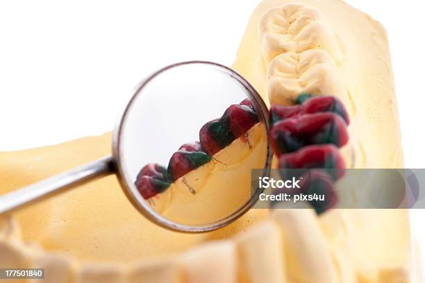 Denture Придают Модели И Инструменты Стоматолога — стоковые фотографии и другие картинки Гигиена - Гигиена, Гипс, Горизонтальный