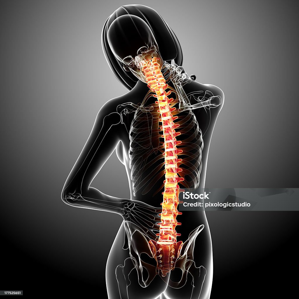 Anatomia del dolore di schiena - Foto stock royalty-free di Anatomia umana