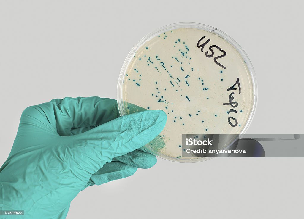 Boîte de Pétri avec bactérienne colonies - Photo de Biologie libre de droits