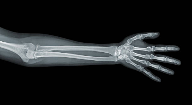 Hand x-ray view Hand x-ray view on a black background x ray image stock pictures, royalty-free photos & images
