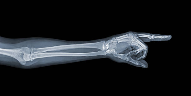 Pointing X-ray hand Pointing X-ray hand on a black background knuckle joint stock pictures, royalty-free photos & images