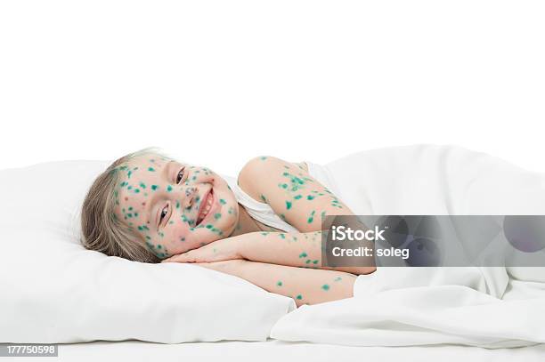 Foto de Sick Garota Na Cama Branca e mais fotos de stock de Acne - Acne, Branco, Cama