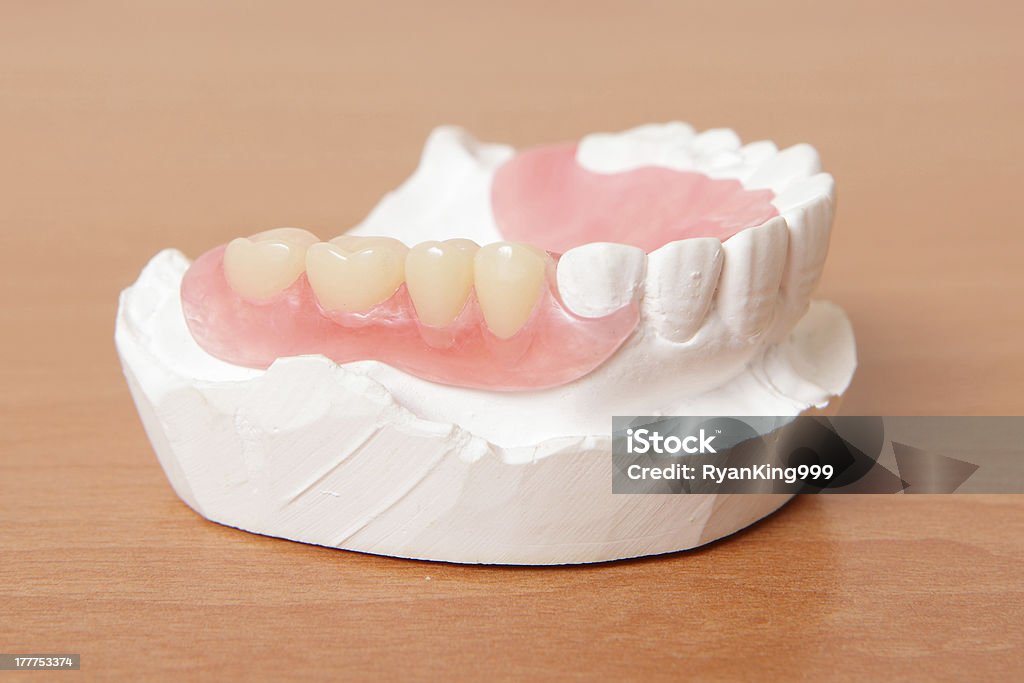Dentadura de acrílico (falso dentes) - Foto de stock de Amarelo royalty-free