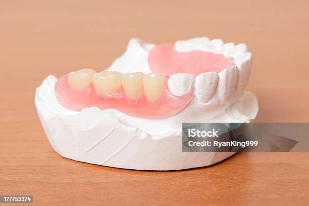 Acrílica De Dentadura Dentes - Fotografias de stock e mais imagens de Amarelo - Amarelo, Artificial, Boca Humana