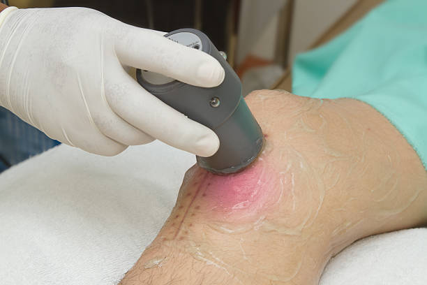 istock Physiotherapist is applying ultrasound therapy on the knee joint 177762698