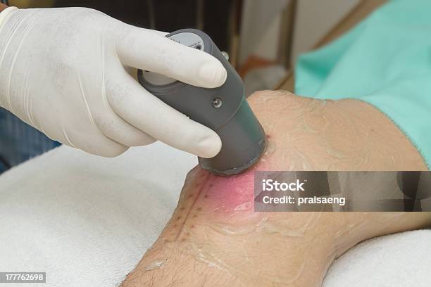 Physiotherapist Is Applying Ultrasound Therapy On The Knee Joint Stock Photo - Download Image Now