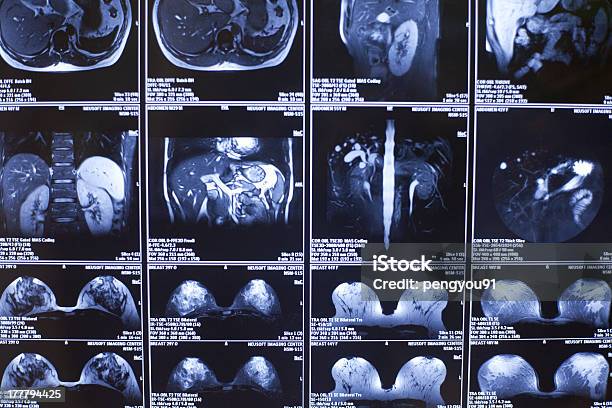 Raggi X La Struttura Del Corpo - Fotografie stock e altre immagini di Anatomia umana - Anatomia umana, Apparecchiatura medica, Bobina di pellicola