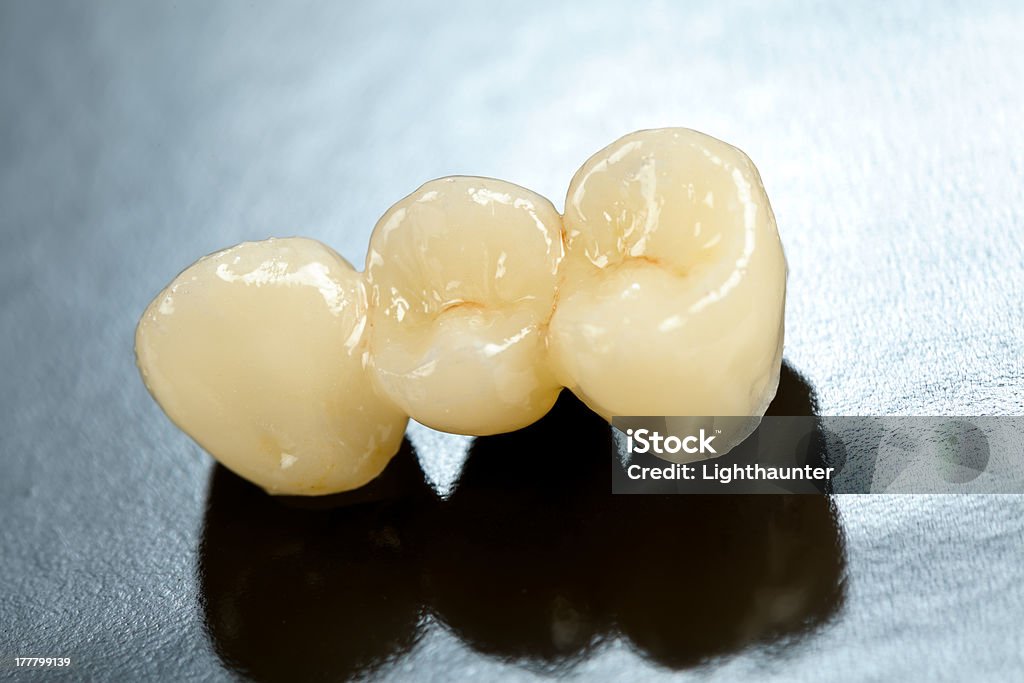 Прессованные пластины зубьев - Стоковые фото Горизонтальный �роялти-фри