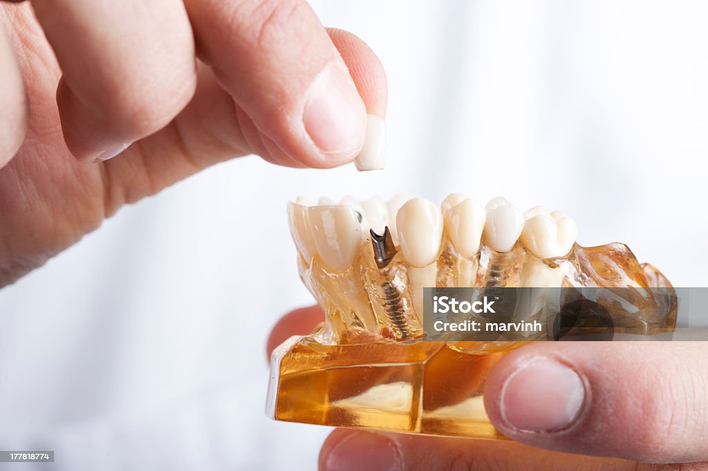 Arzt mit dental Audiosystem - Lizenzfrei Zahnimplantat Stock-Foto