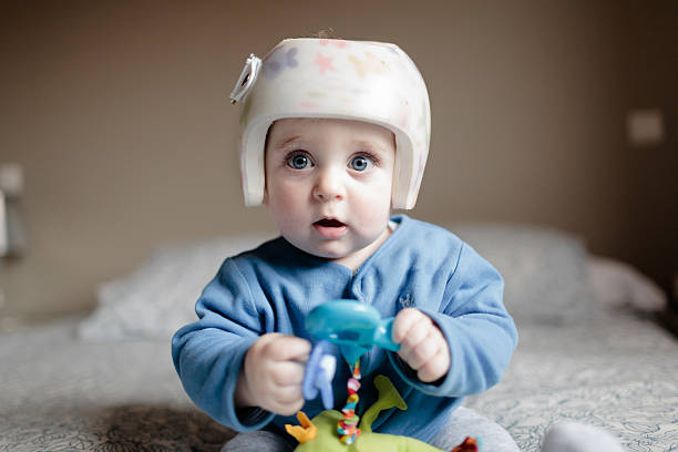 baby with helment for  Plagiocephaly cute baby boy 6 months old looking at camera. He is wearing a helmet to correct plagiocephaly and he is playing with a green toy while wearing a blue jaket plagiocephaly stock pictures, royalty-free photos & images