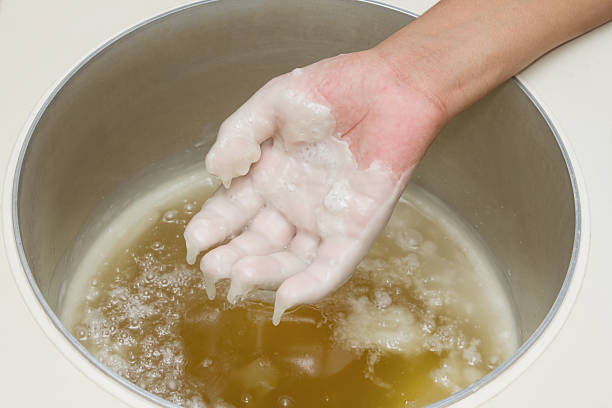 istock Physical therapy treatment and beauty,Hand in paraffin bath 177830957