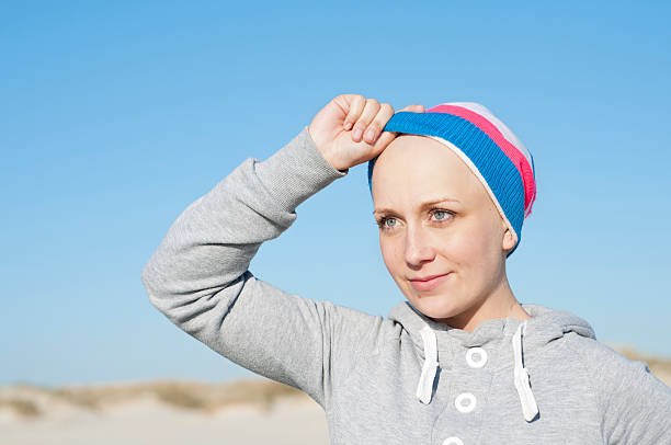 jovem mulher mostrando bald head como efeito secundário de quimioterapia - secondary action imagens e fotografias de stock