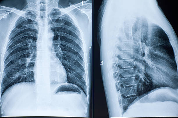 istock X-ray photograph of human organs 177847955