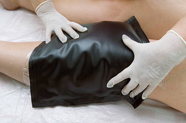 Treatment of arthritis by imposing warm mud pack