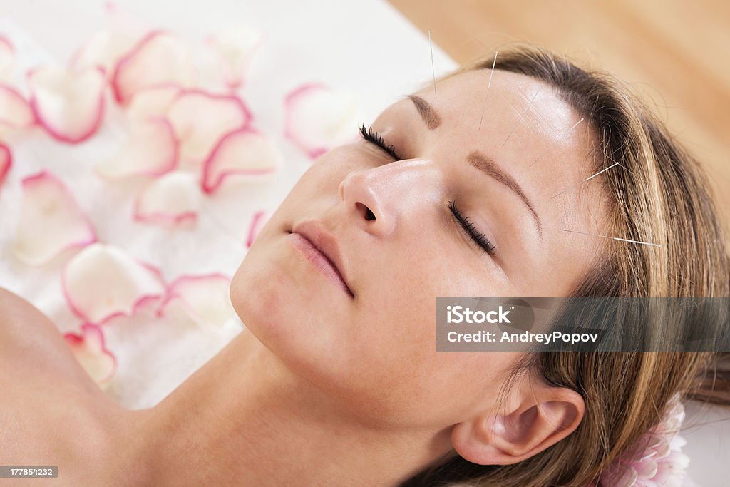 Женщина, проходящих лечение иглоукалыванием - Стоковые фото Иглоукалывание роялти-фри
