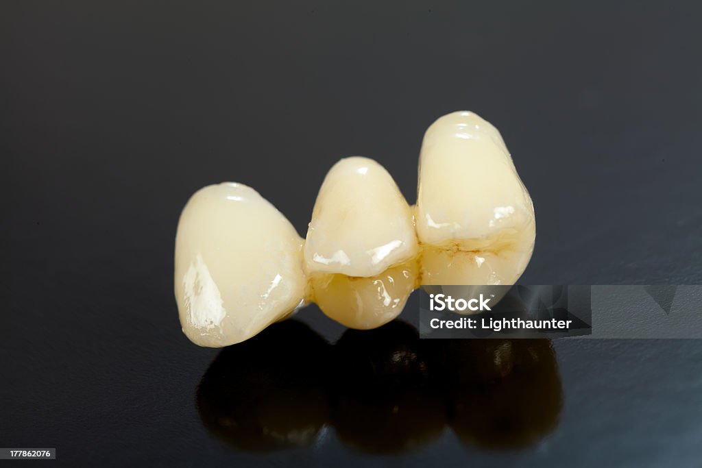 Premuto ceramica denti - Foto stock royalty-free di Accudire