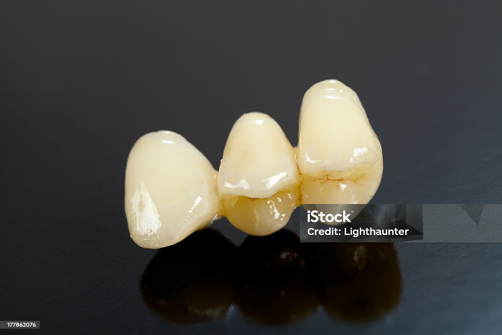 Pressionado cerâmica dentes - Foto de stock de Cerâmica - Artesanato royalty-free