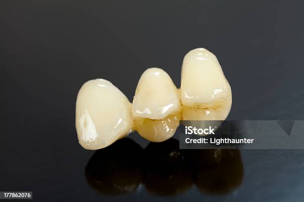 Foto de Pressionado Cerâmica Dentes e mais fotos de stock de Cerâmica - Artesanato - Cerâmica - Artesanato, Consultório Dentário, Coroa dentária