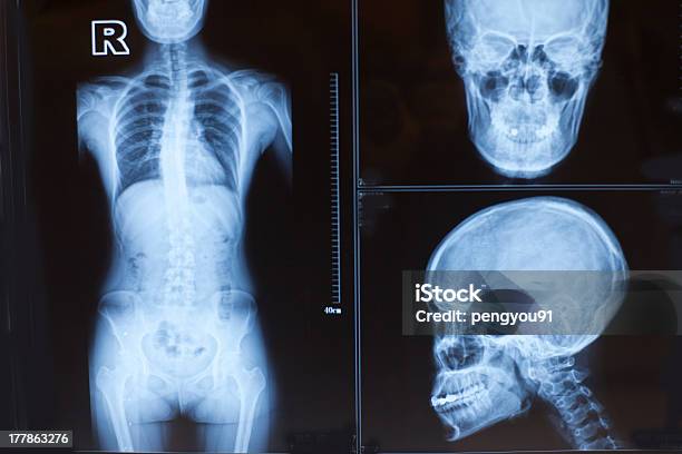 Menschlichen Körper Xray Fotos Stockfoto und mehr Bilder von Anatomie - Anatomie, Biomedizinische Illustration, Blickwinkel-Aufnahme