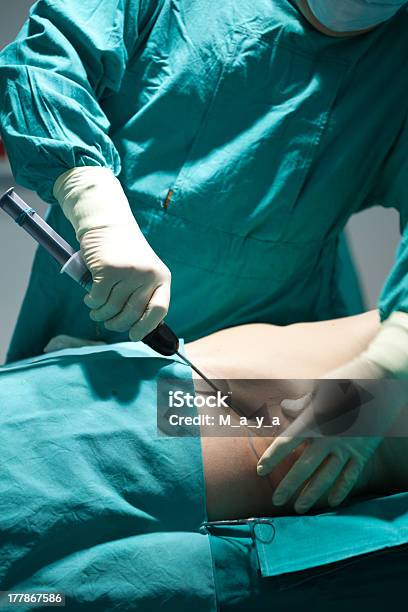 Fettabsaugung Stockfoto und mehr Bilder von Arzt - Arzt, Ausrüstung und Geräte, Chirurgienadel