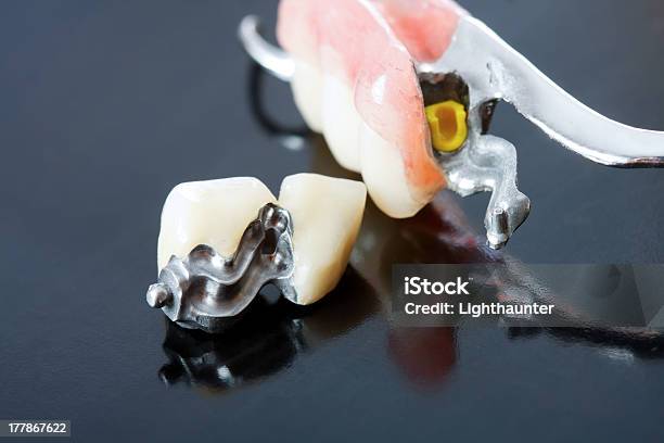 Foto de Prosthesis Dentário e mais fotos de stock de Prótese esquelética - Prótese esquelética, Amarelo, Arte e Artesanato - Assunto