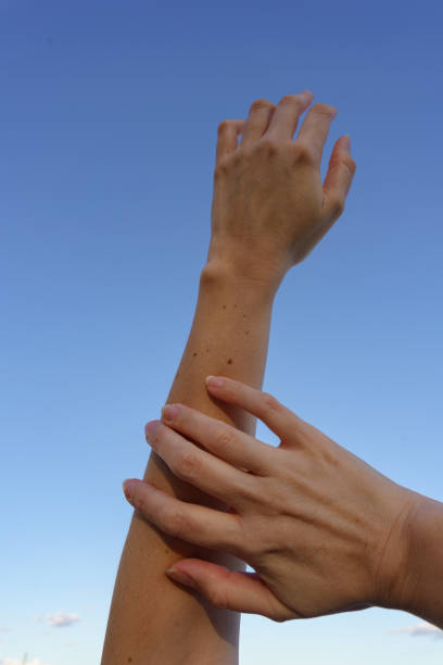 istock Examining Freckled Arms in the Sky 1778700938