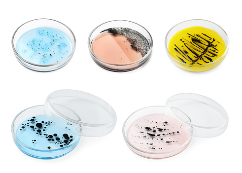 Set of Petri dishes with different culture samples on white background