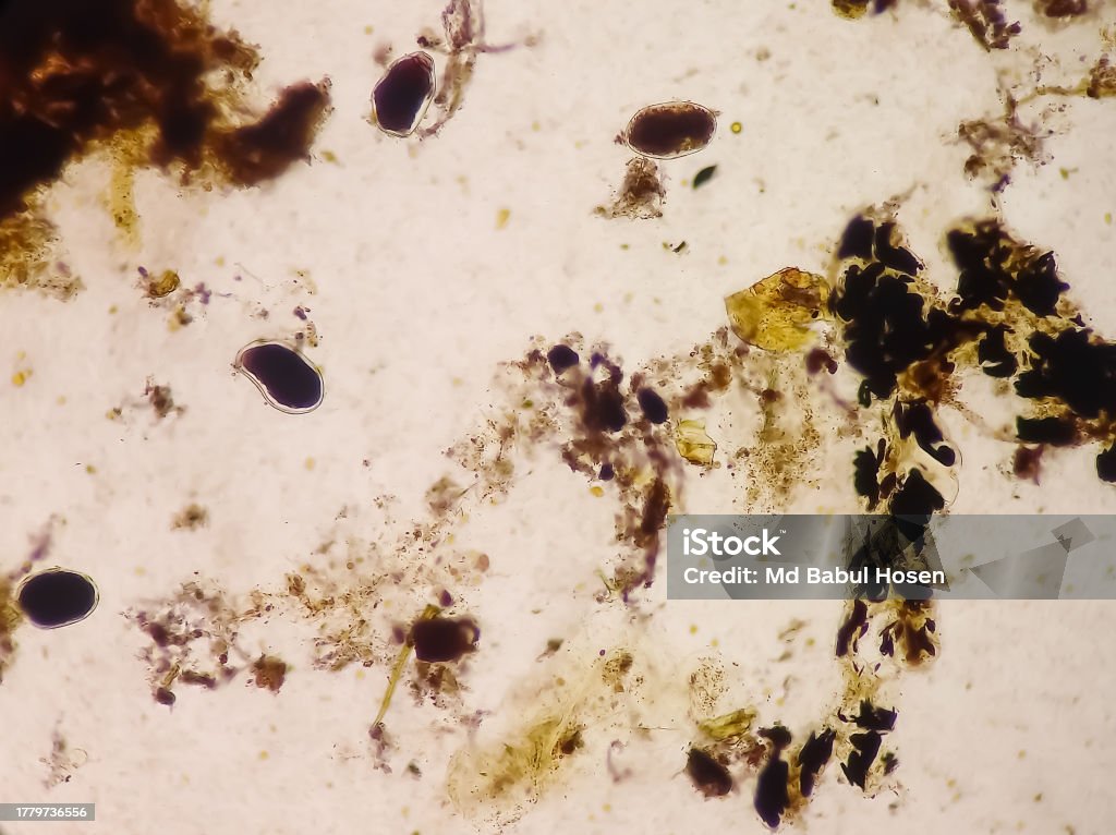 Parasitic Ova And Cysts And Trophozoite Form Muscle Fiber In Stool