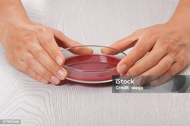 Blut In Petri Gerichte Stockfoto und mehr Bilder von Analysieren - Analysieren, Ausrüstung und Geräte, Bakterie