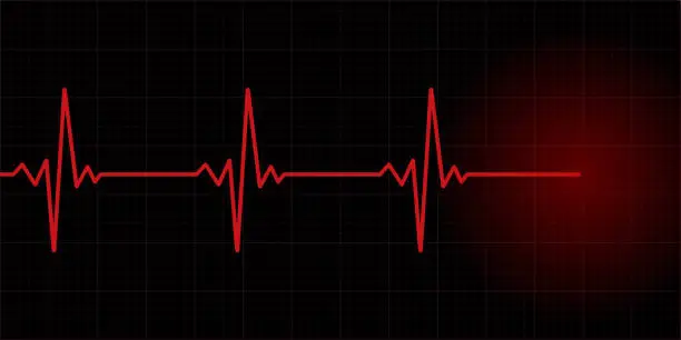 Vector illustration of Red heart rate line on screen indicates cardiac arrest. Electrocardiogram. Vector illustration