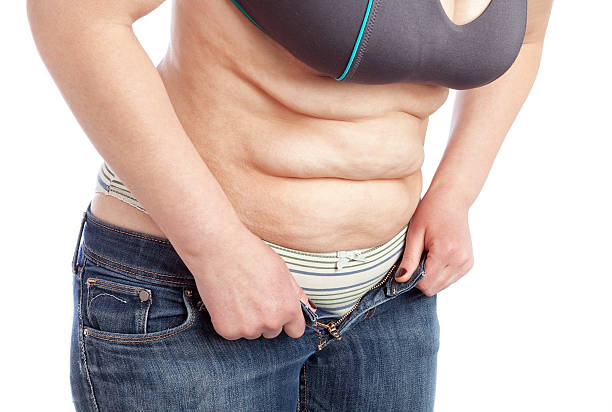 istock Middle-aged woman shows belly with excess fat. 178017813