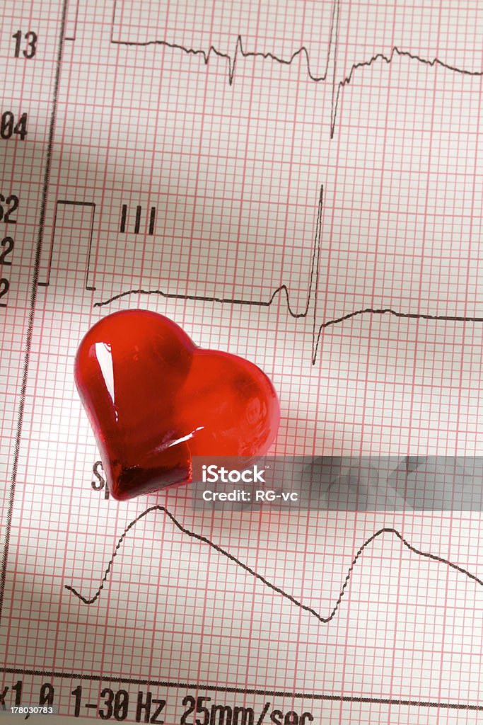 ECG Electrocardiogram - Photo de Analyser libre de droits