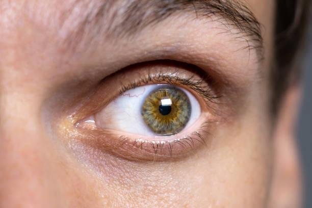 istock Red tyred men's eyes, close up. 1780370804