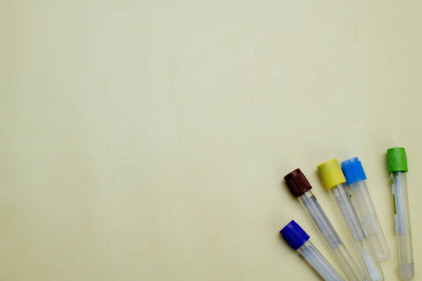 istock Vacuum tubes for collection and blood samples on yellow background with space for text 1780461508
