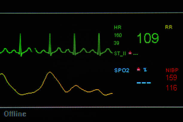 istock EKG monitor in ICU unit 178126070